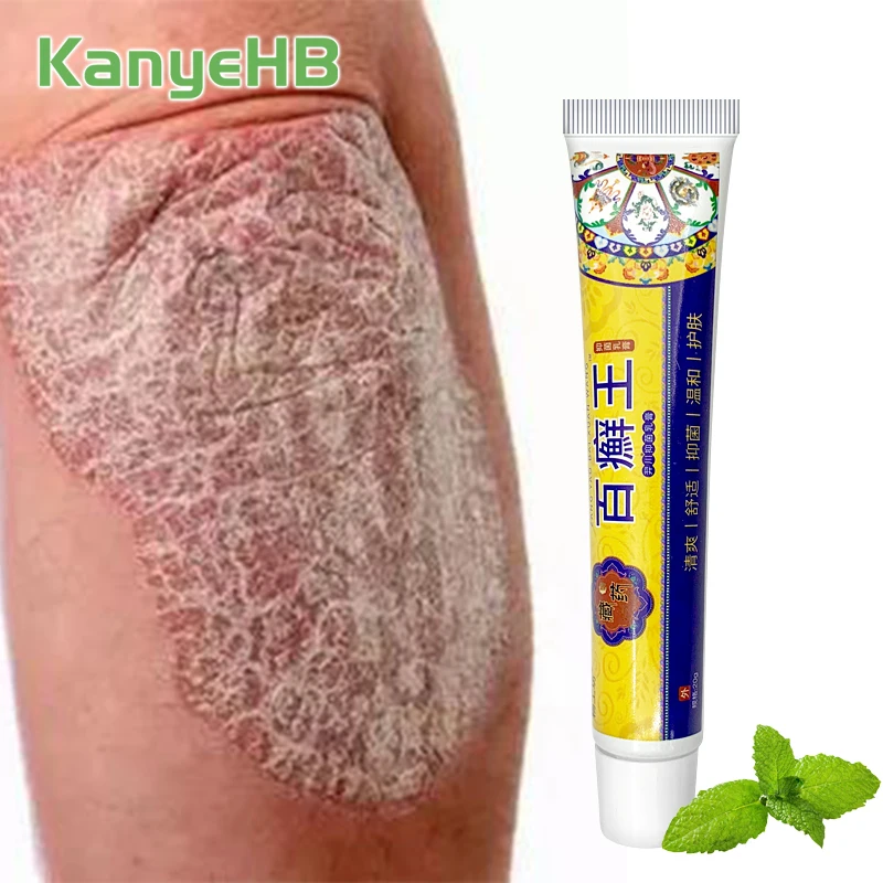 1pcs Psoriasis Antibacterial Cream Long-lasting Antifungal Cool Mint Anti-itch Formula Repair Damaged Skin Jock Itch Papule S118