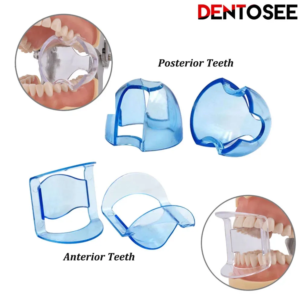 Alta qualidade abridor de boca dental, clareamento dental, intraoral, bochecha retrator, lábio para anterior, dentes posteriores