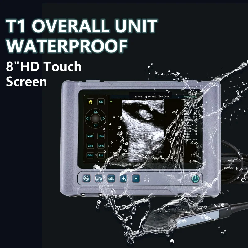One-Stop Medical Supplies Handheld Ultrasound Scanners Portable Diagnostic Ultrasound Devices