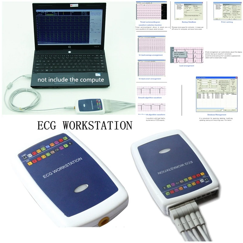 

CONTEC8000G brand new ECG workstation based on 12 resting lead analyzer recording system