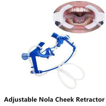 1 set Dental Lip Cheek Retractor Nola Dry Space System Teeth Whitening Mouth Opener Suction Tubes Adjustable Orthodontic Blue