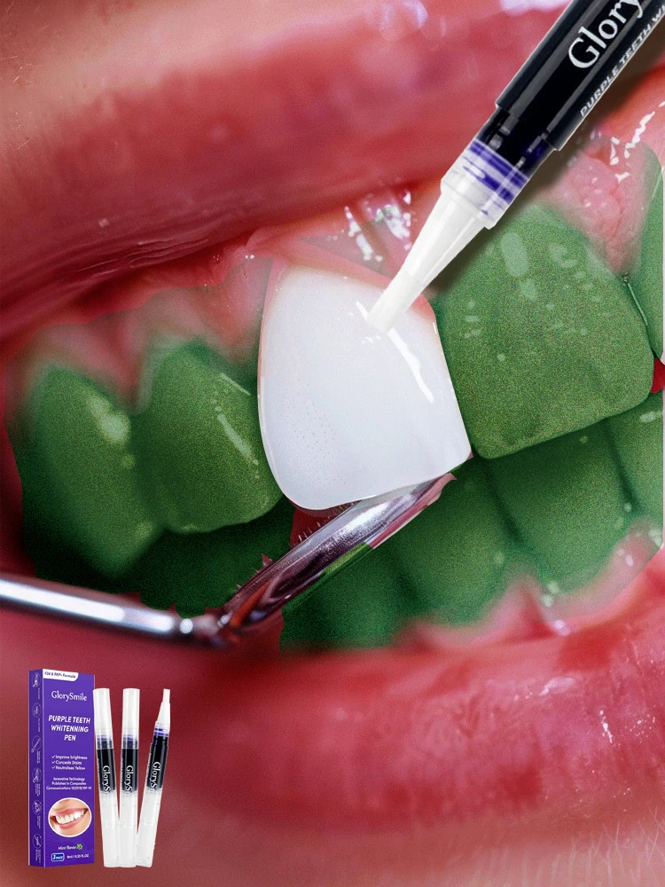 

Фиолетовая ручка для мгновенного отбеливания зубов, зубная паста для очистки зубного камня, без чувствительности, для ярчести, белой улыбки, ухода за карнизом