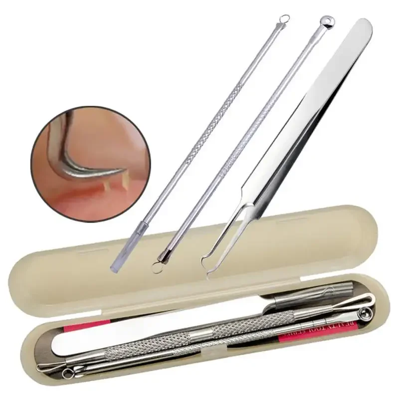 Stainless Steel Acne Removal Needle Pimple  Comedone  Treatment Extractor Face Care Tool