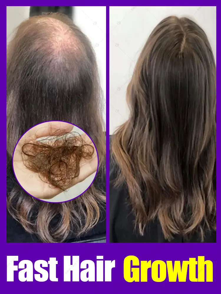 

развивает волосы