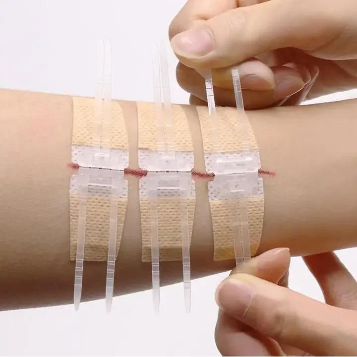 Быстрая доставка Индивидуальная упаковка Steri Strips Нетканое устройство для закрытия ран для производителя ран с меньшими шрамами