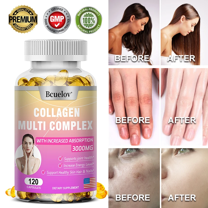 Collagen Complex Capsule Hydrolyzed Protein, High Absorption 3000mg Promotes Hair and Nail Health