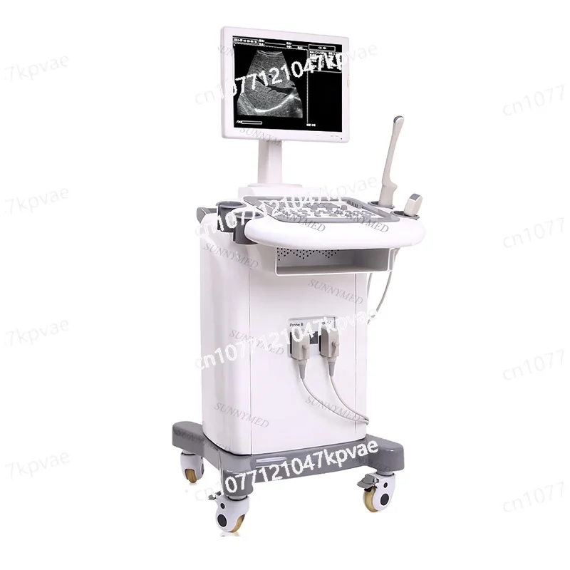 

SY-A020 Hospital Trolley Pregnancy Scanner Ultrasound B Ultrasound with Trolley