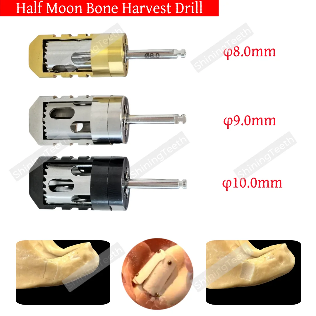 

New Dental Half Month Bone Sampling Drill Bone Incremental Bone Slice Drilling φ8.0/9.0/10.0mm