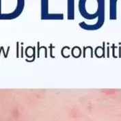 Wizualny przyrząd do usuwania zaskórników z kamerą, narzędzie do usuwania pryszczy, zestaw do czyszczenia porów na trądzik, komedony, białe i czarne kropki.