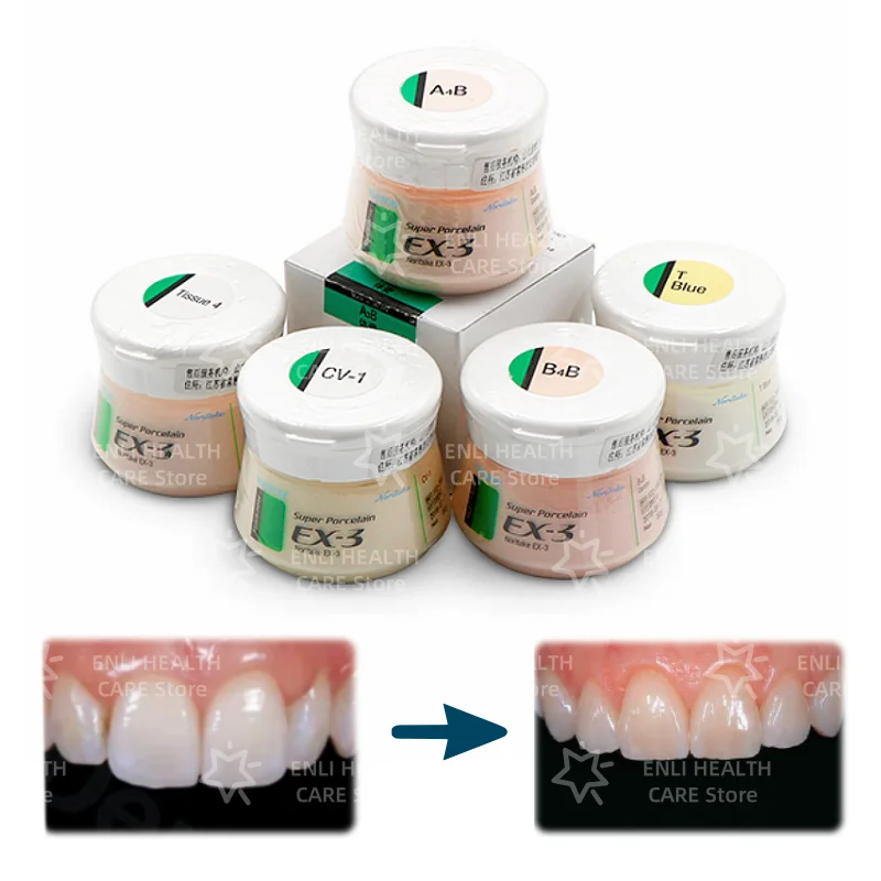 50 جرام/صندوق Noritake EX-3 مسحوق بورسلين فائق الجسم Kuraray Noritake مسحوق بورسلين سيراميك معدني لترميم الأسنان