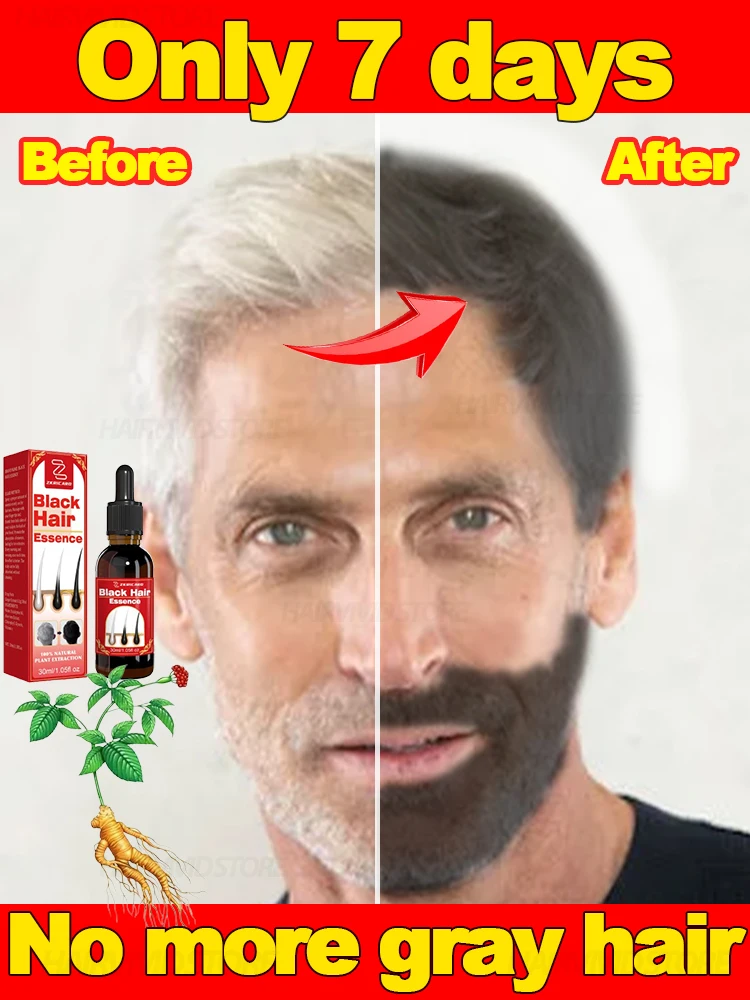 100% Effective Gray Hair Restoration Natural Hair Color Gender: Unisex Hair Style