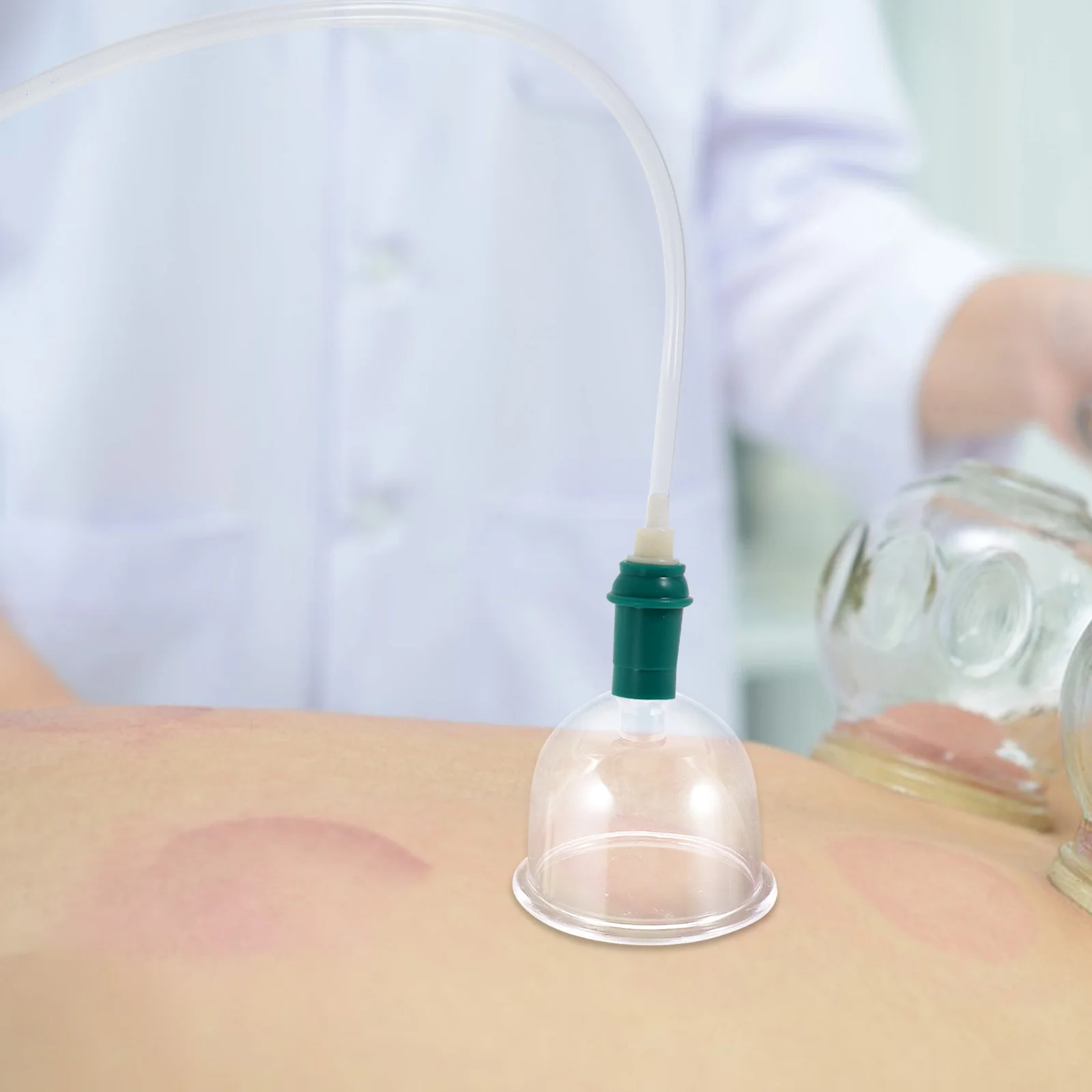 Zestaw do bańek z pompką do masażu, tradycyjna chińska terapia, usuwanie wilgoci, urządzenie do próżniowego masażu ciała, ergonomiczny kształt uchwytu.