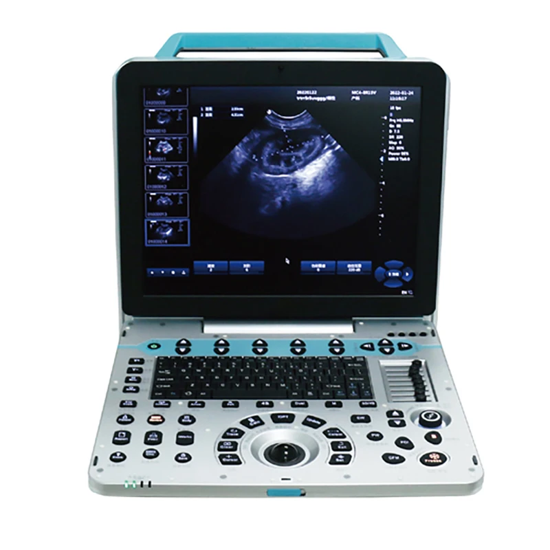 MN-Ultra5 Best Selling 3D/4D/5D Color Ultrasonic Diagnostic Apparatus Full Digital Veterinary Portable Ultrasound Machine