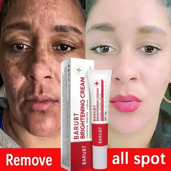 Whitening Sproeten Gezichtscrème Verwijdering Melasma Donkere Vlekken Corrector Lichter Melanine Pigmentatie Fleuren Anti-Aging Schoonheidsverzorging
