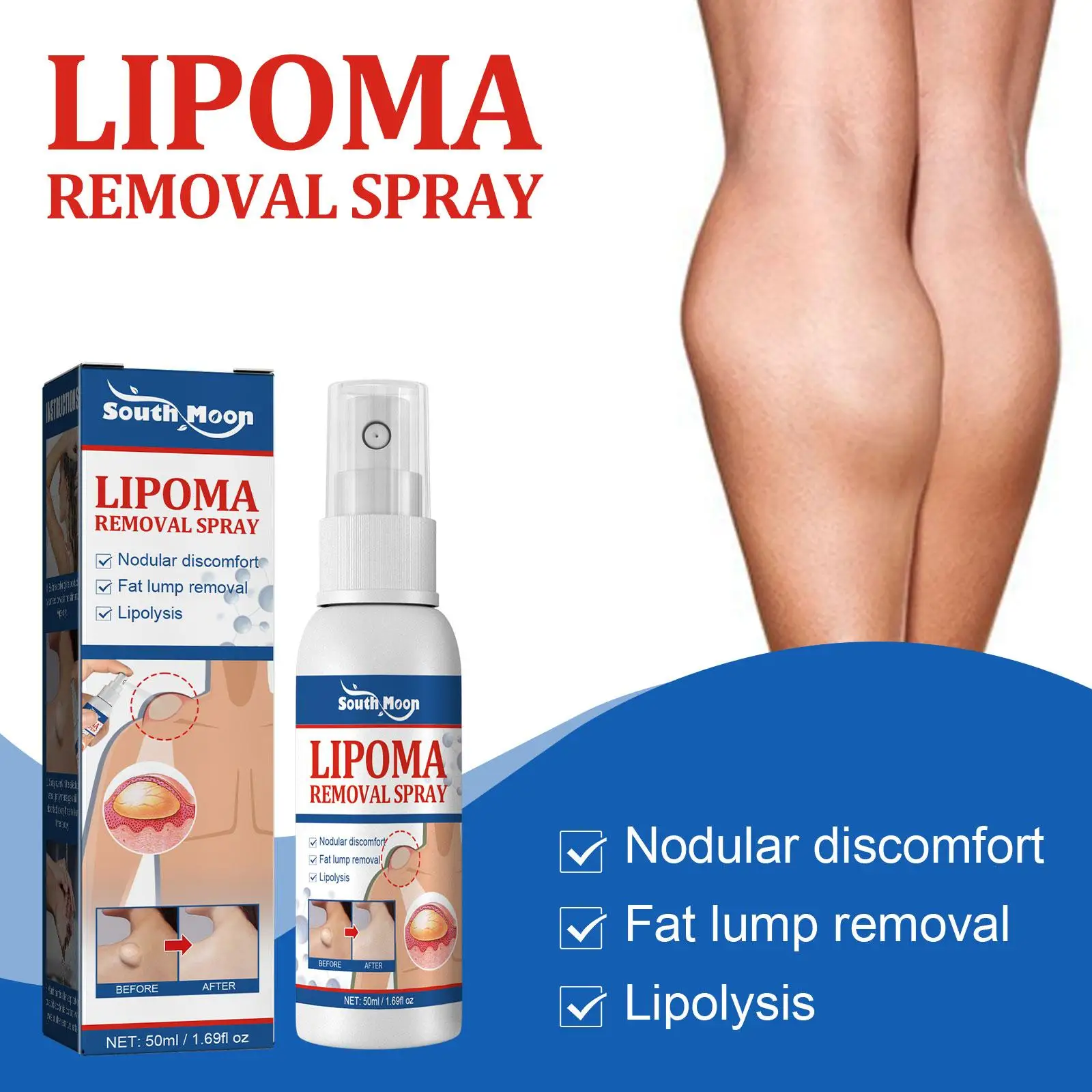 Lipoma Removal Spray Pain Treatment For Skin Swelling Fat Soluble Cellulite Fat Nodule Removal Cream Anti-tumor 50ml