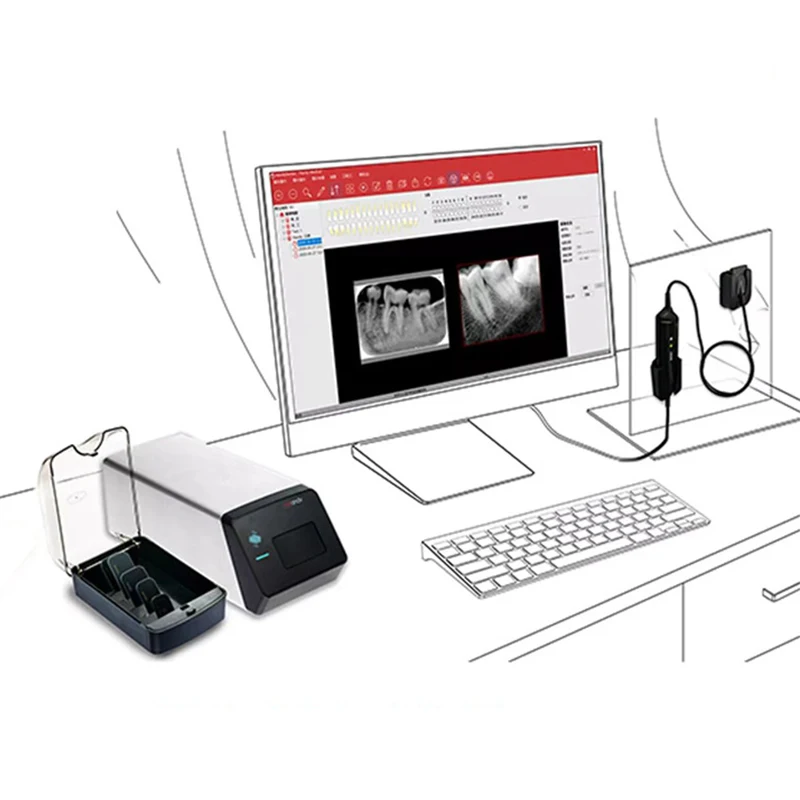 Dental Image Plate Scanner Digital Dental Phosphor Plate Scanner High Resolution Fast Scan X-ray Imaging Equipment RVG Image