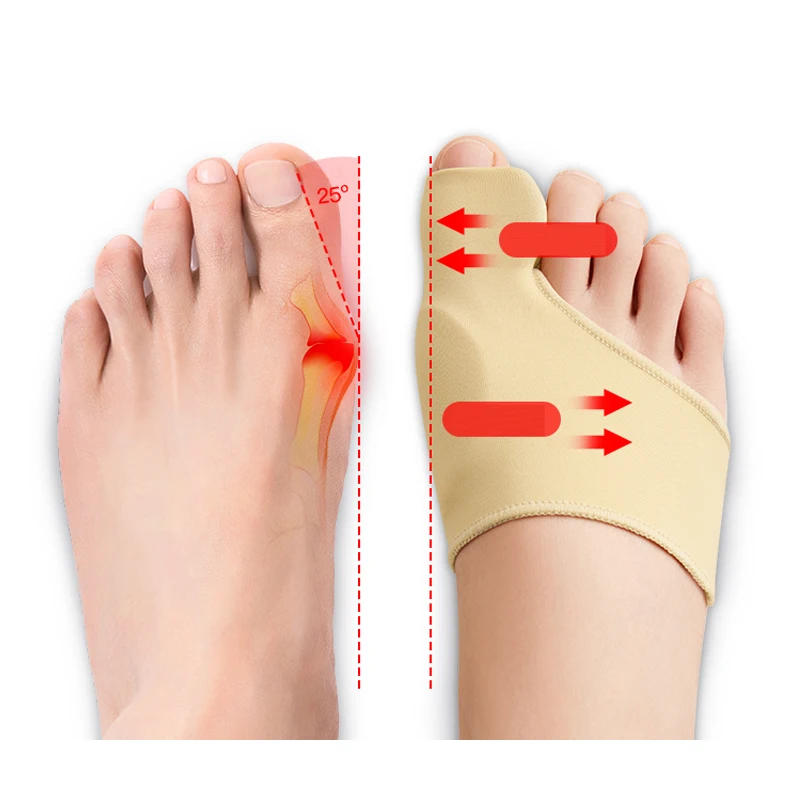 Bunion Corrector Halux Valgus Corrector Bunions Corrector For Women Toe Separator Foot Finger Separators Hallux Valgus Corrector