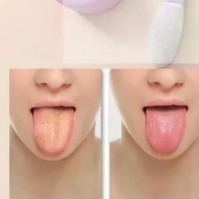 منظف مكشطة اللسان للأطفال البالغين، 2 في 1 فرشاة لسان من السيليكون وكاشطات لسان من الفولاذ المقاوم للصدأ للأسنان منعشة #1