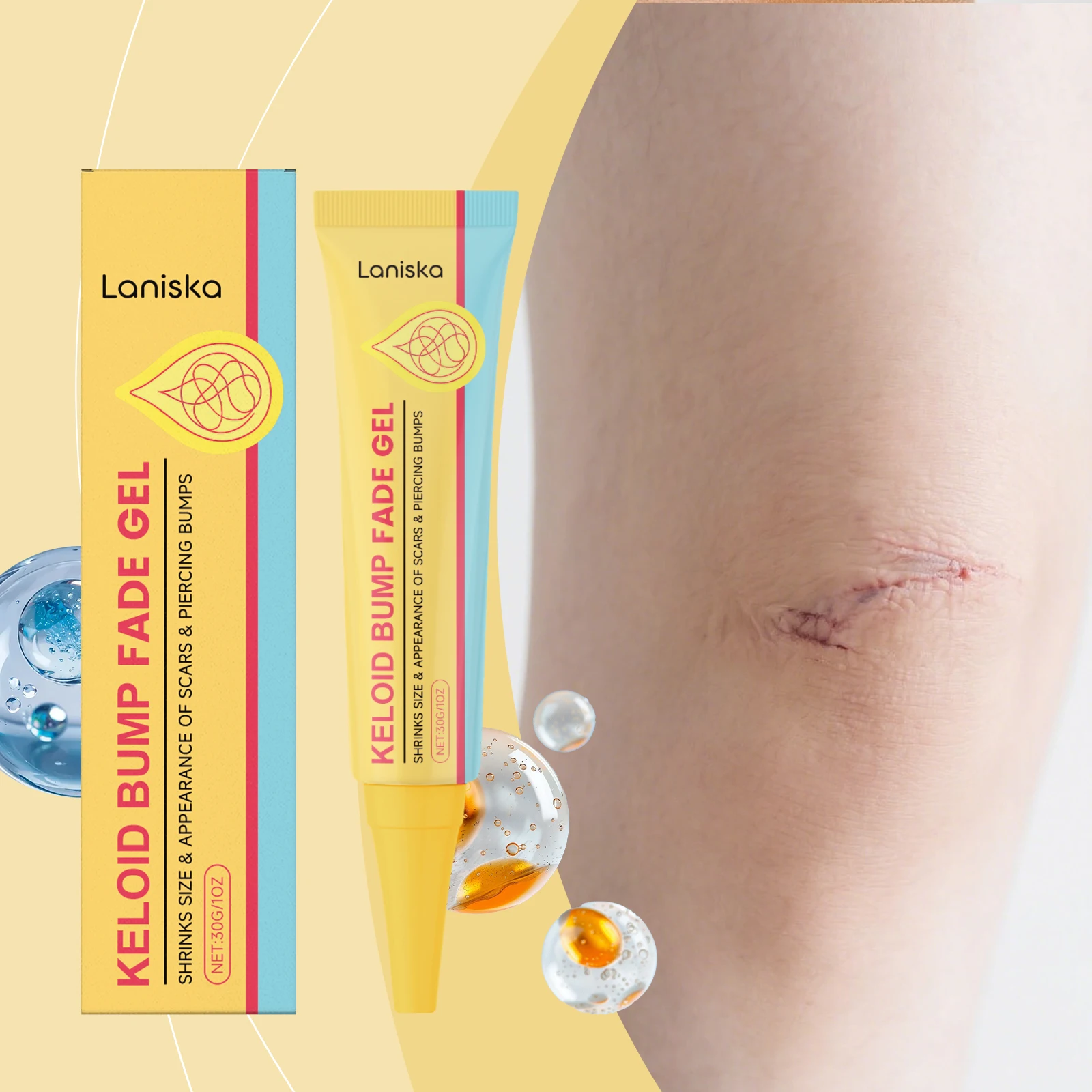 Keloid Bump Fade Gel Comfortable Refreshing Texture Shrink Scar Bumps Reduce Redness Itching Repair Damaged Skin Care Products