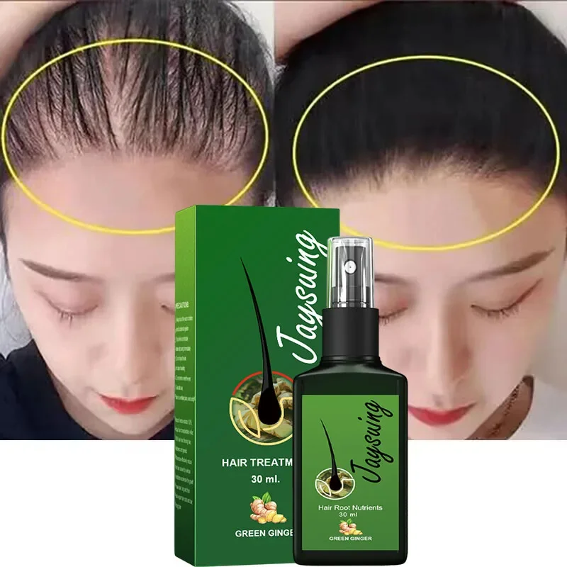 

Fast Hair Growth Spray Anti Hair Loss Serum Prevent Baldness Scalp Treatment Repair Dry Damaged Beard Hair Care For Men Women