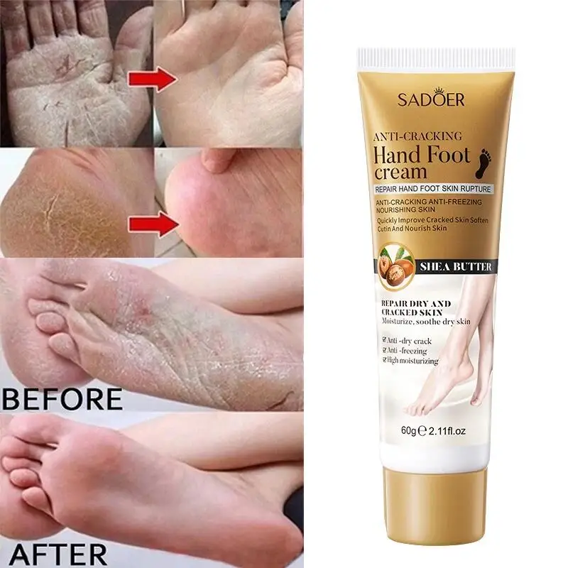 Anti Crack Hand Foot Cream Anti-Drying Heel Cracked Repair Feet Mask Removal Dead Skin Moisturizing Whitening Feet Care Products