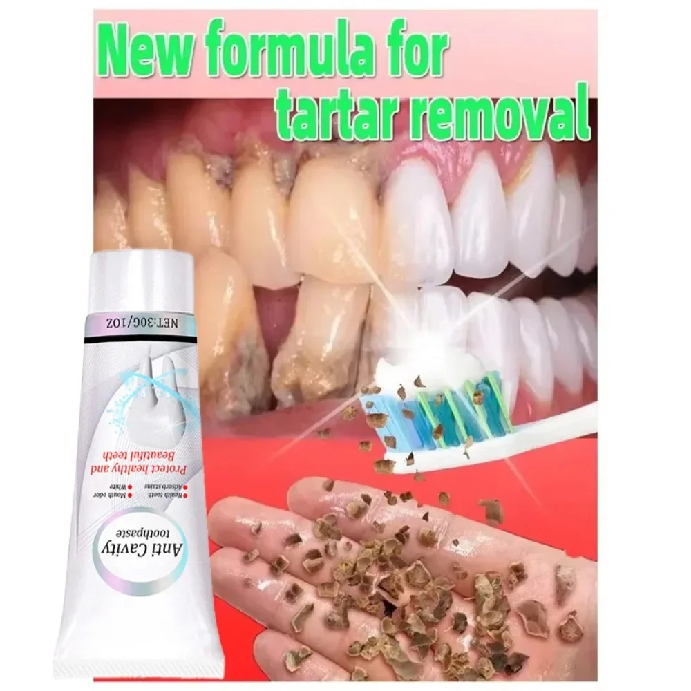 Useful Toothpaste Prevent And Repair Tooth Decay Remove Plaque Whiten Teeth Relieve Periodontitis Toothache Freshen Bad Breath