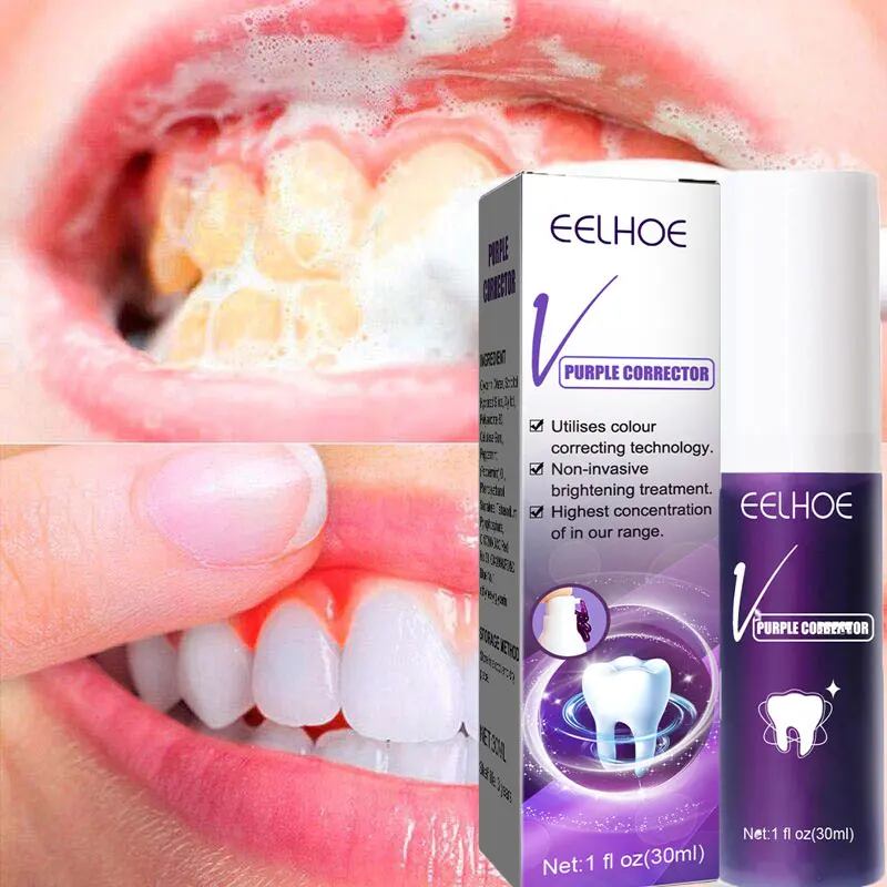 Whitening Tooth Toothpaste Freshen Breath Remove Smoke Stains Oral Hygiene Clean Effectively Removal Yellow Teeth Dental Care