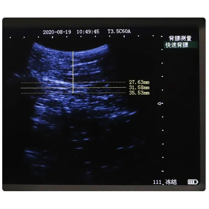 5 inch LCD screen portable veterinary ultrasound scanner, cattle, sheep and horse farm ultrasound pregnancy Rectal probe