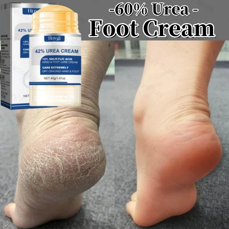 

60% Urea Foot Cream Aloe Vera Ultra-hydrating Softening Dry Cracked Feet Cream Gentle Exfoliation Daily Foot Care Solution 40g