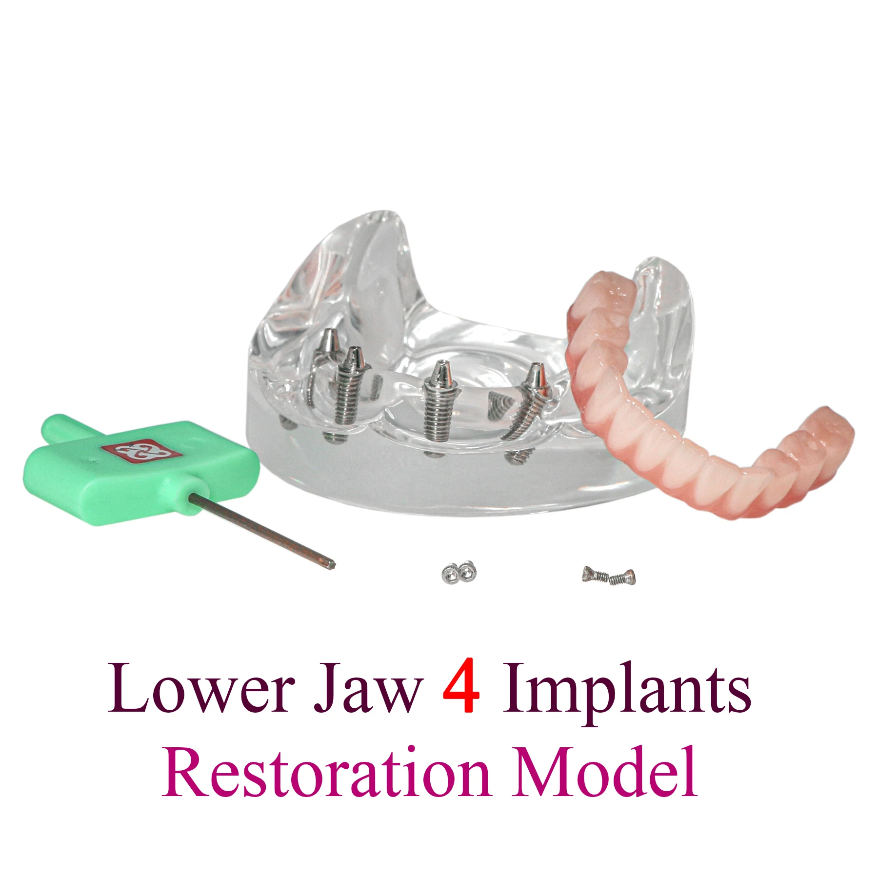 1Pc Dental Implant Model Lower Jaw 4 Implants Overdenture Restoration Removable Teeth Model Dentisit Teaching Demo Model