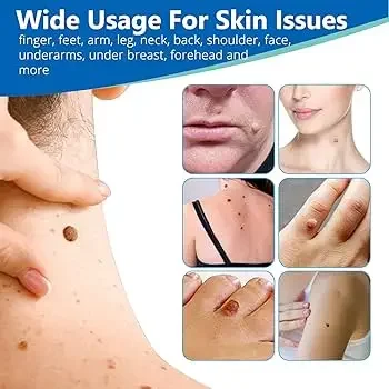 الضوء الأزرق، بالإضافة إلى تخفيضات أجزاء #3