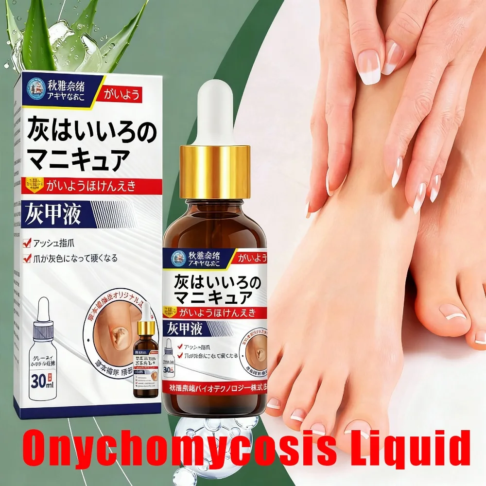 سائل إصلاح الأظافر 30 مل حل علاج فطريات الأظافر Tinea Unguium للأظافر المتغيرة اللون والتالفة