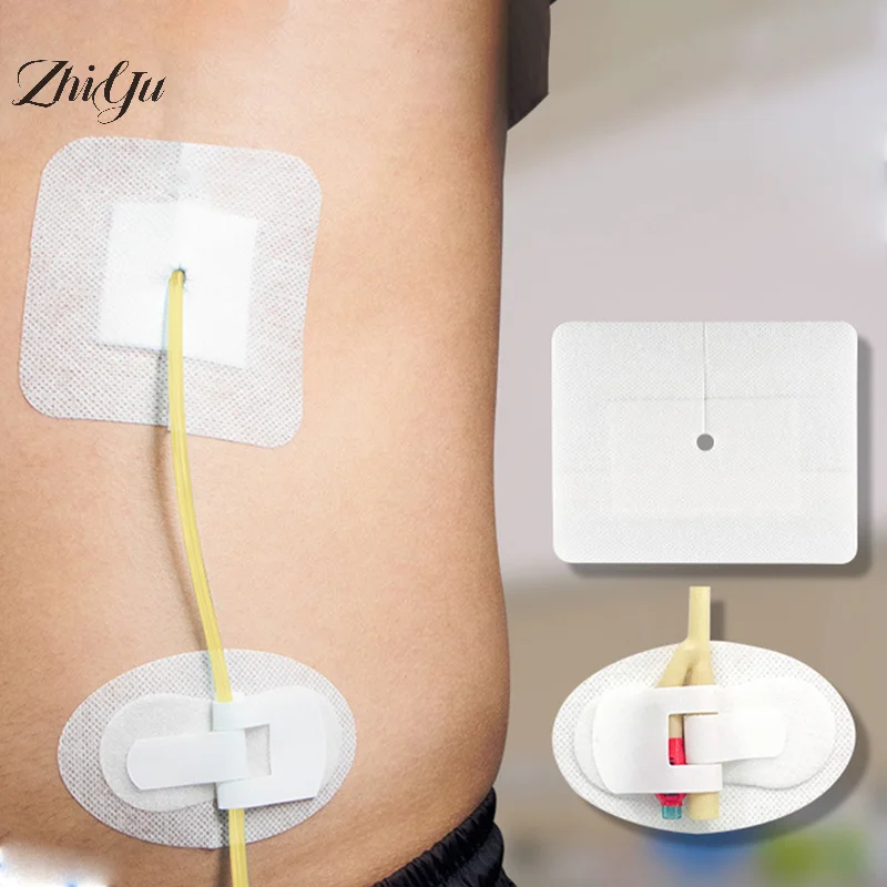 5Pcs Drainage Tube Sterile Applicator Peritoneal Dialysis Catheter Bile Duct Nephrostomy Gastric Tube Drainage With Hole Sticker