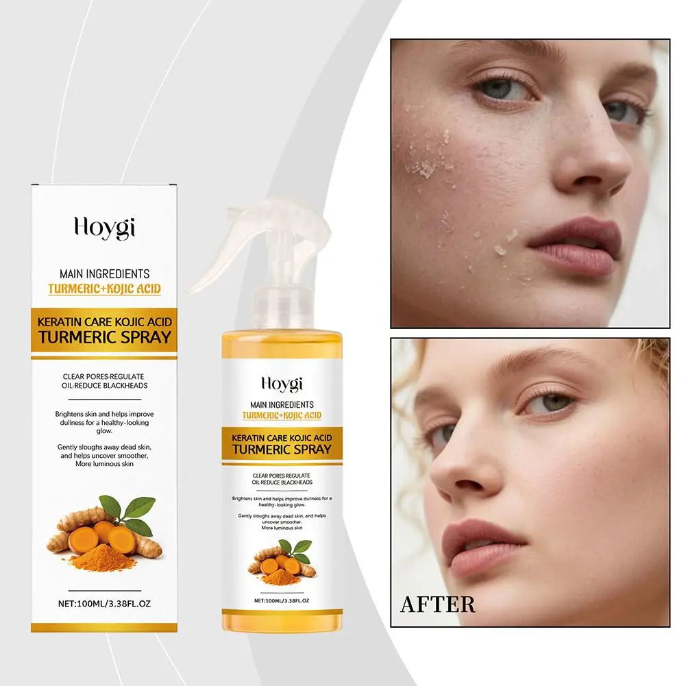 بخاخ تقشير حمض الكوجيك والكركم - لا حاجة إلى أدوات، تفتيح لطيف وتجديد لجميع أنواع البشرة، بشرة محمولة C P3S4 #1