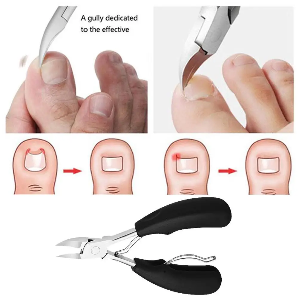 Tijeras para uñas encarnadas, alicates para manicura, herramienta removedora de cutículas, pedicura, cortador de piel, Q6b9