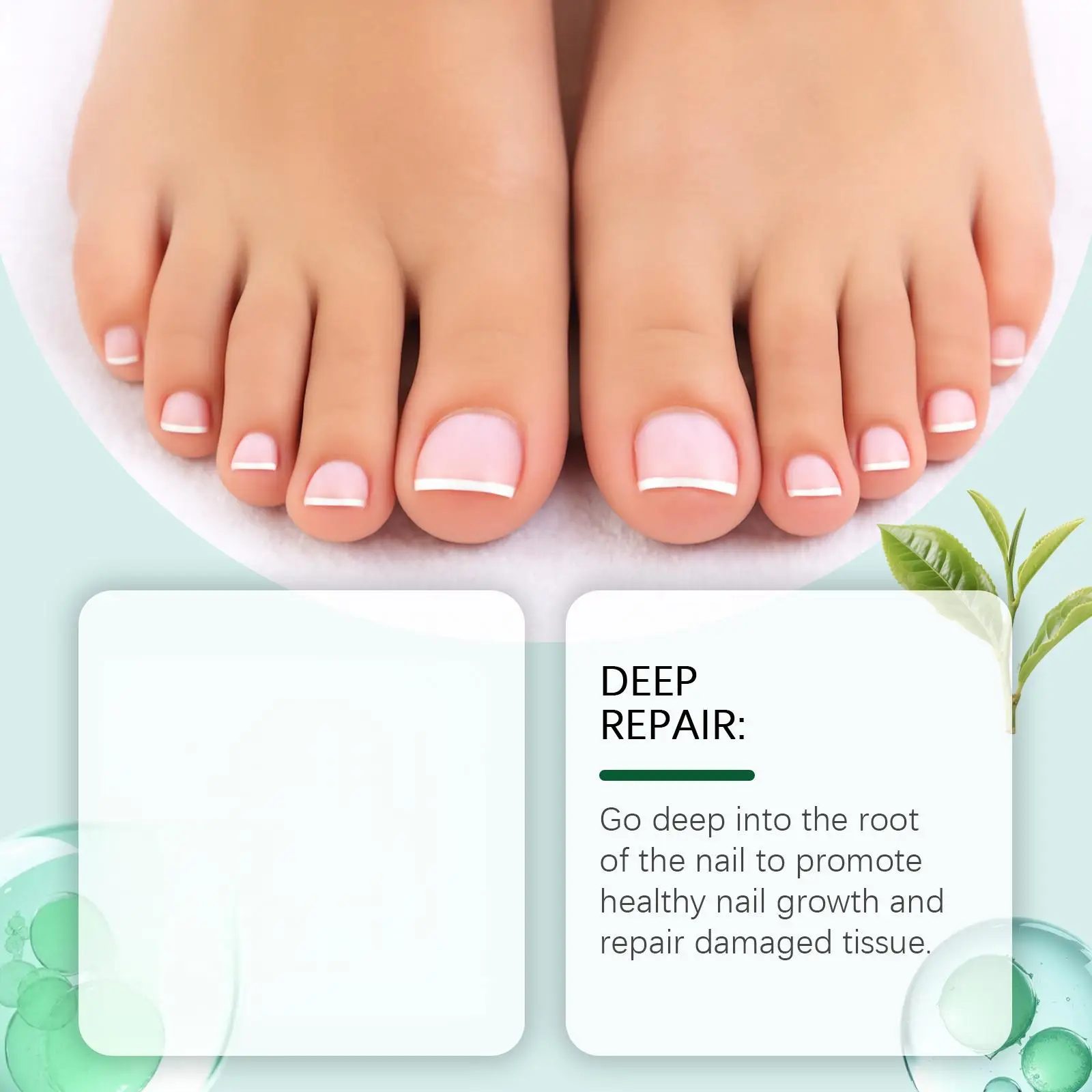 جل علاج فطريات أظافر القدم زيت شجرة الشاي للعناية بالأظافر صحة الجمال تلميع الأظافر استعادة زيت القرفة جل إصلاح الأظافر الفطرية