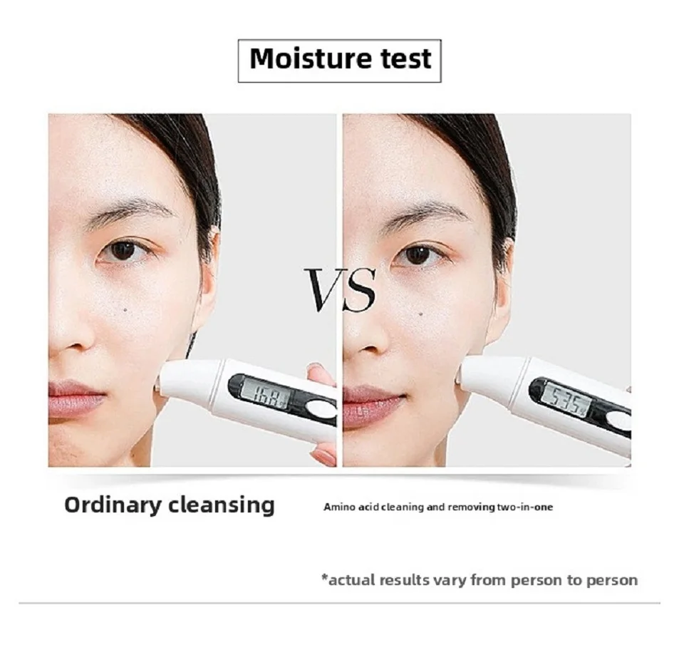 400ml Aktive Blasenmaschine Spezielle Sauerstoff-Kleinblasenlösung Spezielles Serum für Tiefenreinigung & Feuchtigkeitspflege des Gesichts – Detail 9