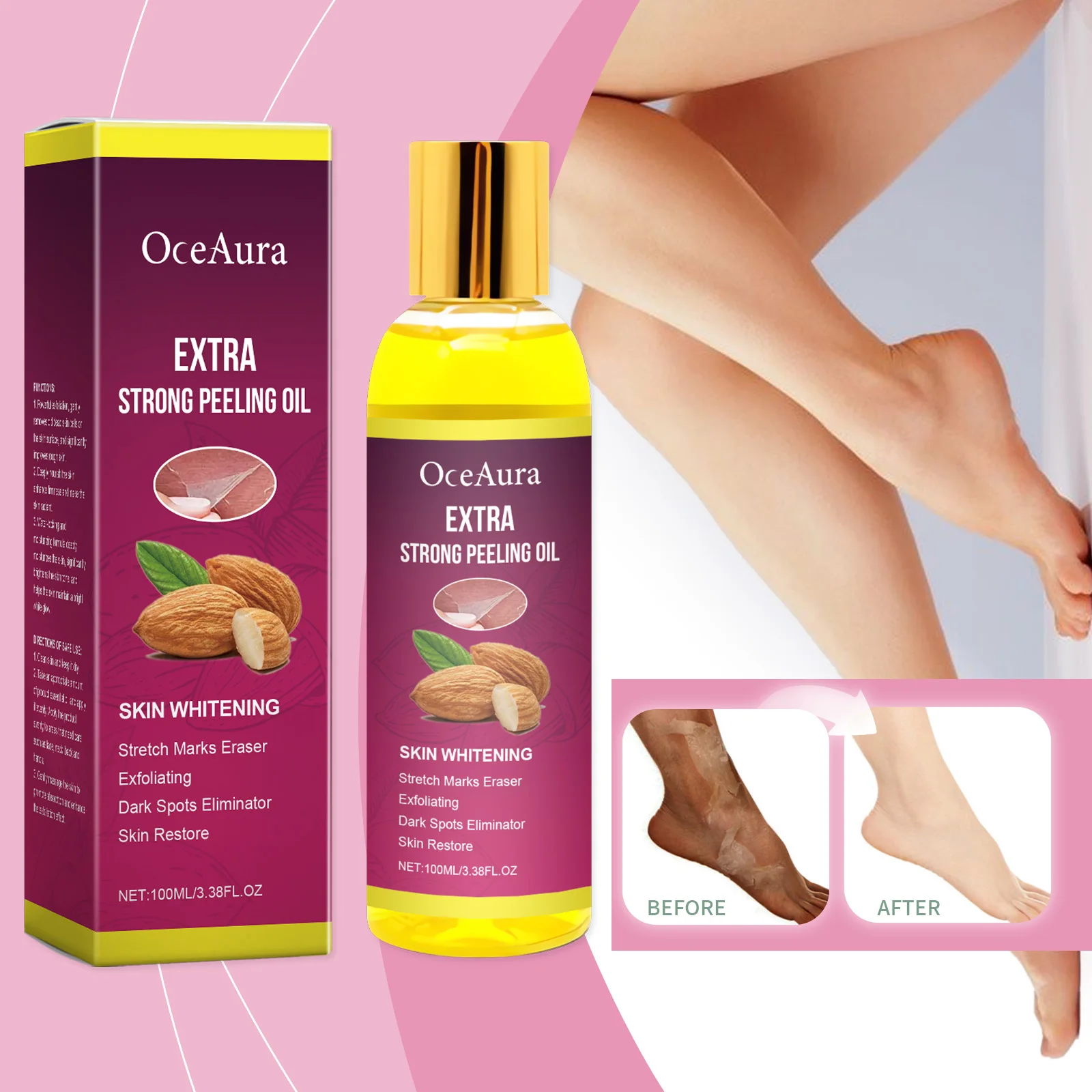 엑스트라 스트롱 필링 오일 - 스트레치 마크, 다크 스팟을 위한 피부 미백 및 각질 제거 트리트먼트 - 100ml/3.38FL.OZ 딥 리스토어링