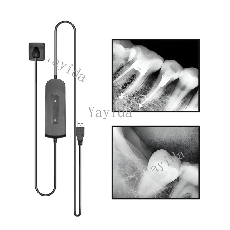 Dental Sensor Digital Intraoral System High Frequency HD Imaging for Dentist Lab Implant Equipment Tools dental radiographer