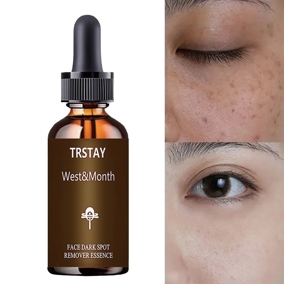 

TRSTAY Эссенция для лица, отбеливание, восстановление, удаление морщин, отбеливание пятен, увлажнение для ухода за кожей