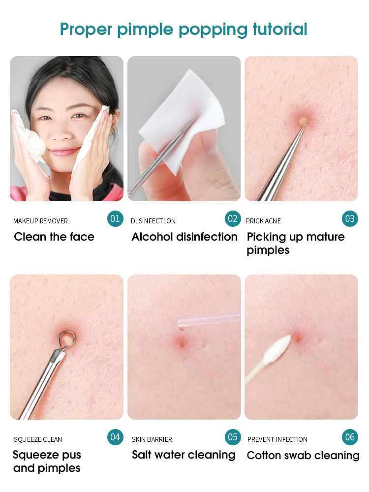 Super Puntige Celclip Acne Naald Set, Ultrafijne Pincet, Mee-Eter Verwijderen En Acne Verwijderen Naald Schoonheid Tool