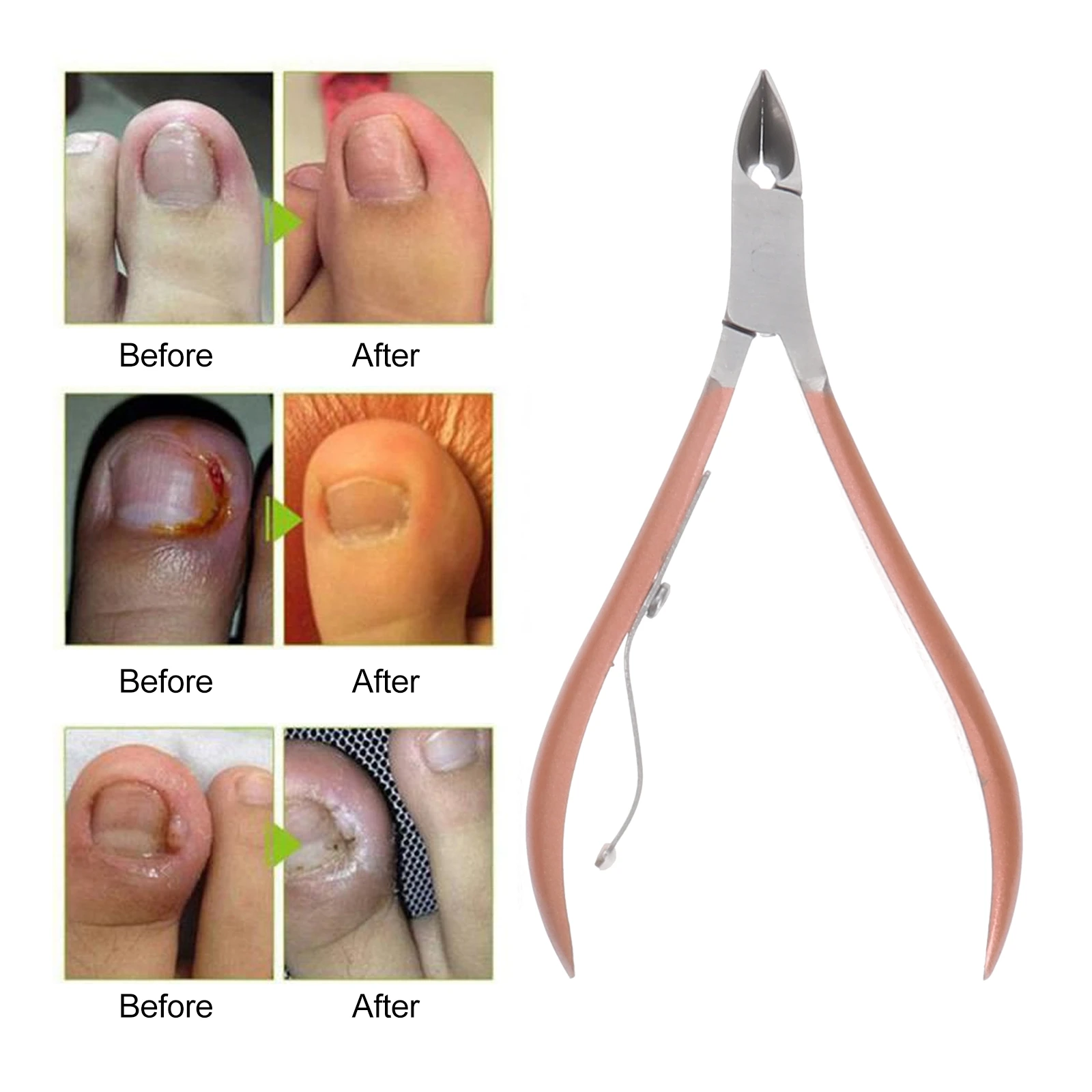 

16pcs Nail Manicure Set Stainless Steel Multi-Functional Pedicure Tools Rose Gold Ergonomic Durable Rustproof Nail Clippers File