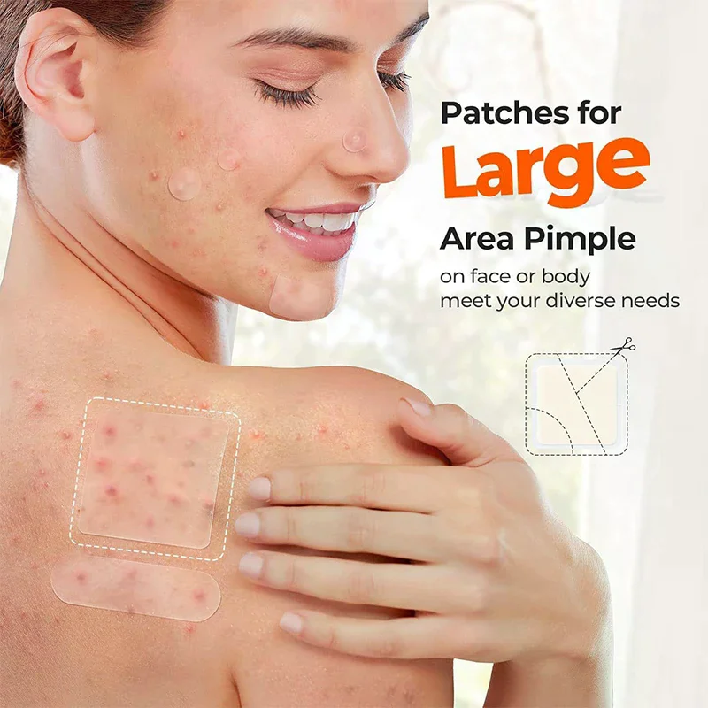 Hydrokoloidowe, niewidoczne plastry na trądzik - Plastry na trądzik usuwające ropę, naklejki na twarz, nos, ciało, pielęgnacja skóry, plastry na niedoskonałości.