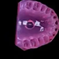 

28 зубьев, обучающая модель зубного имплантата со съемными зубьями, стандартная модель челюсти Typodont, мягкая резинка, демонстрационные модели для стоматологической лаборатории