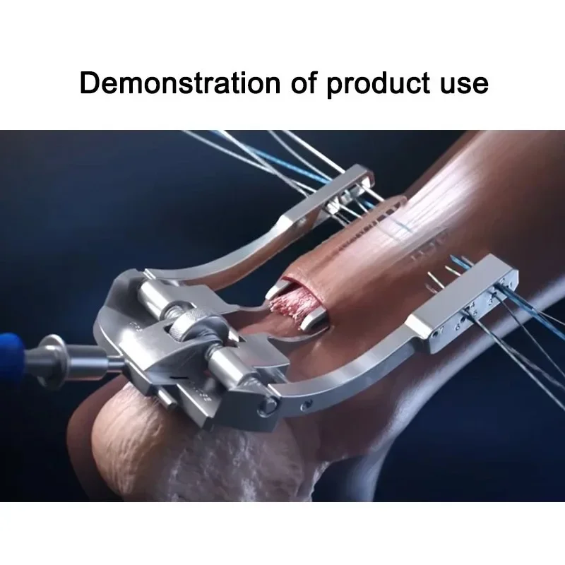 Stainless‑Steel Pet Achilles Tendon Reduction Instrument, Veterinary Orthopedic Manipulation Tool