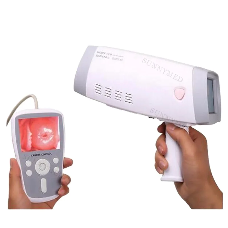 

SY-F005 hospital digital colposcope machine handheld electronic colposcopy