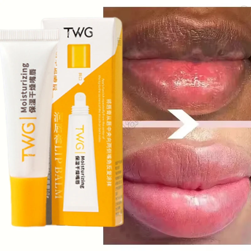 Entfernen Sie dunklen Lippenbalsam, Vitamin C, hellt Melanin, Glanzöl, Peeling, sauberes Pigment, abgestorbene Haut, verblasst Lippenlinien, Schönheitspflege, Make-up