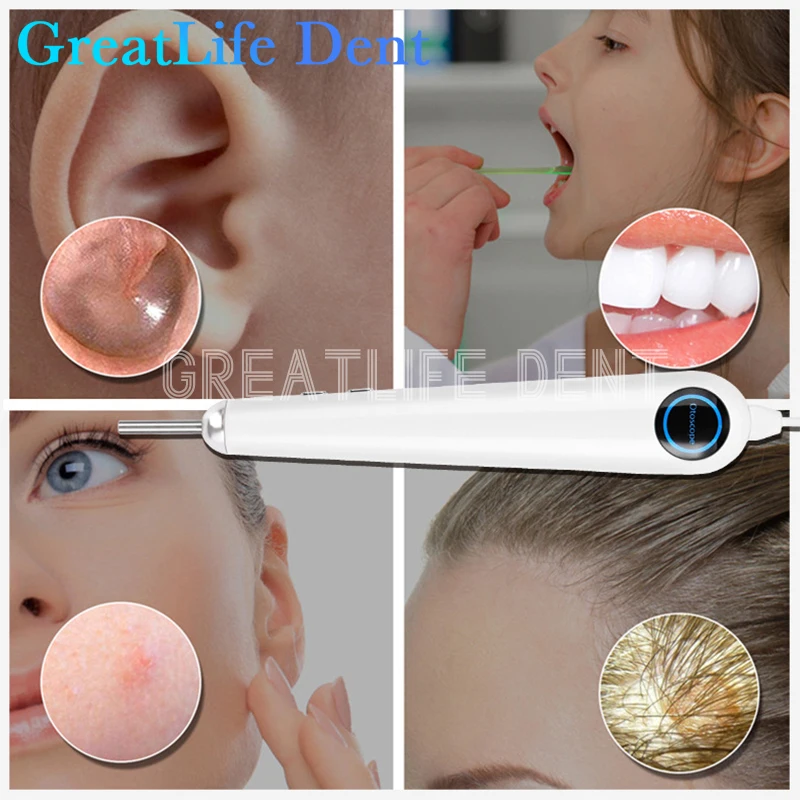 GreatLife Dent Integrated 7-inch Display With 3.9mm Viewable Dental Intraoral Camera Dental Camera Intraoral Camera Intra Oral