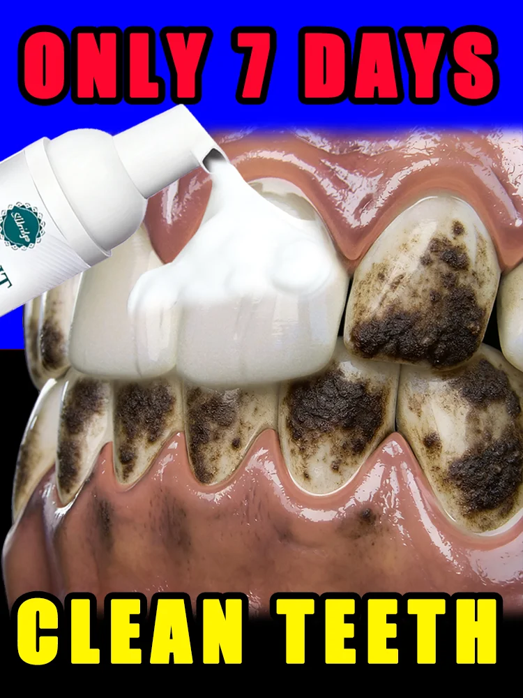 

Deep Cleansing and Polishing,oral foam,free shipping,Portable Daily Use and Travel