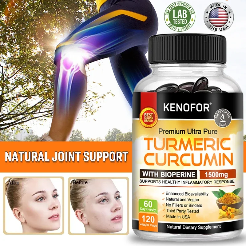 Curcumin & Black Pepper - Highly Absorbed, Ultra-Strength Turmeric Supplement - for Joint Support, Pain Relief, Antioxidant